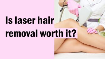 Is laser hair removal worth it?